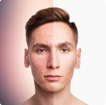 SKIN & FACE treatment at Toronto medical spa - Every treatment—whether it's collagen stimulation,...